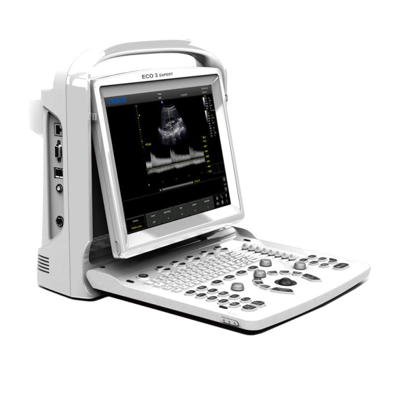 Ecógrafo CHISON ECO3 Expert con sonda convexa (C3-A)