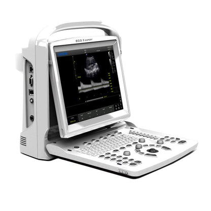 Ecógrafo CHISON ECO3 Expert con sonda convexa (C3-A)