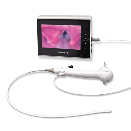 Monitor de Broncoscopia