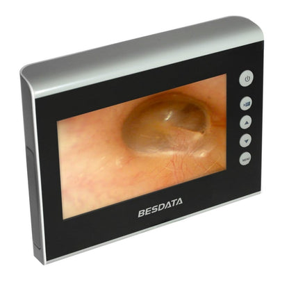 Monitor de Broncoscopia