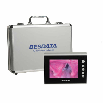 Monitor de Broncoscopia